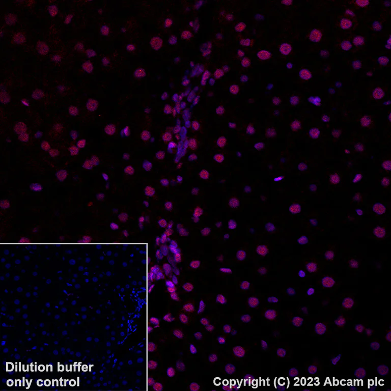 Immunohistochemistry (Formalin/PFA-fixed paraffin-embedded sections) - Alexa Fluor® 647 Anti-RBM3 antibody [EPR6061(2)] (AB314932)