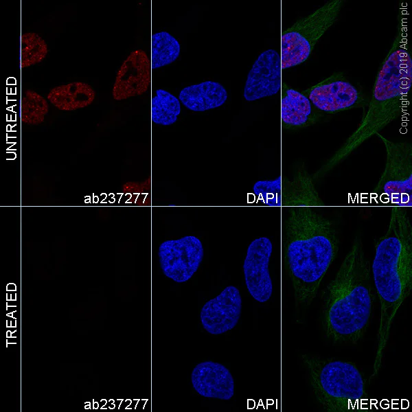 Immunocytochemistry/ Immunofluorescence - Alexa Fluor® 647 Anti-RNA polymerase II CTD repeat YSPTSPS (phospho S5) antibody [EPR19015] (AB237277)