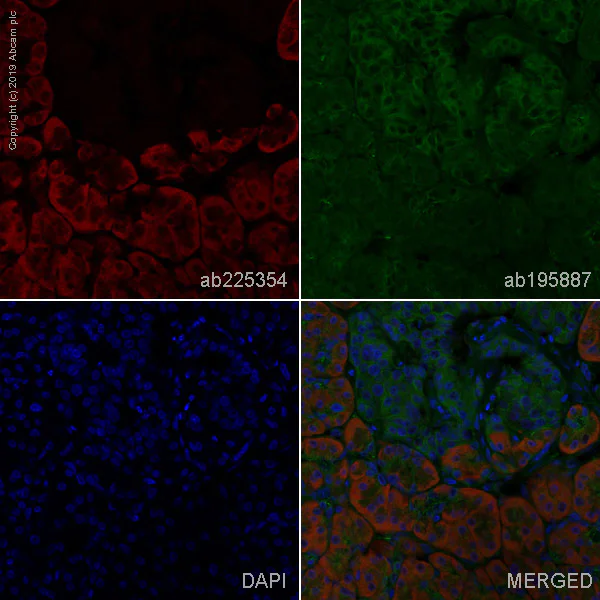 Immunohistochemistry (Formalin/PFA-fixed paraffin-embedded sections) - Alexa Fluor® 647 Anti-ROS1 antibody [EPMGHR2] (AB225354)