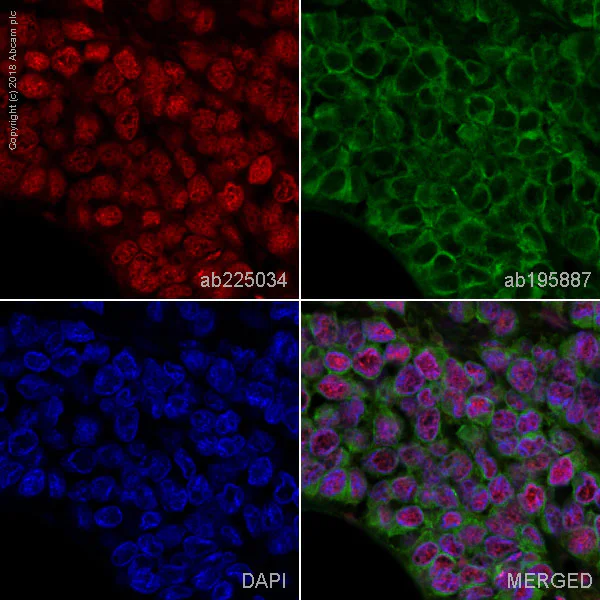 Immunohistochemistry (Formalin/PFA-fixed paraffin-embedded sections) - Alexa Fluor® 647 Anti-RPA32/RPA2 antibody [EPR2877Y] (AB225034)