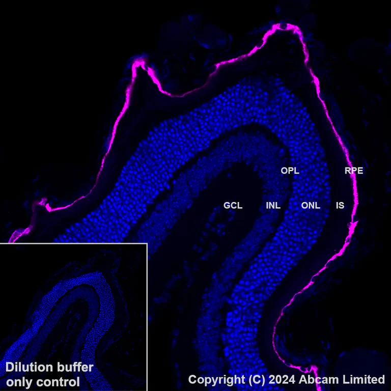 Immunohistochemistry (Formalin/PFA-fixed paraffin-embedded sections) - Alexa Fluor® 647 Anti-RPE65 antibody [EPR22579-44] (AB322022)