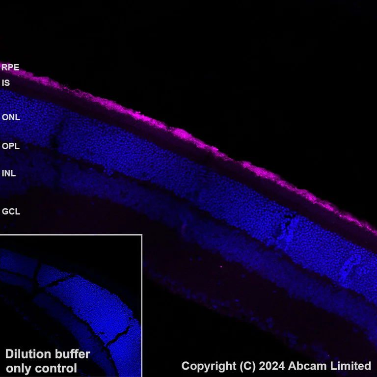 Immunohistochemistry (Formalin/PFA-fixed paraffin-embedded sections) - Alexa Fluor® 647 Anti-RPE65 antibody [EPR22579-44] (AB322022)