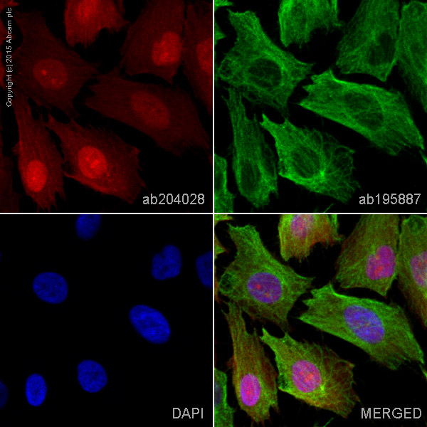 Immunocytochemistry/ Immunofluorescence - Alexa Fluor® 647 Anti-S100 alpha 6/PRA antibody [EPNCIR121] (AB204028)