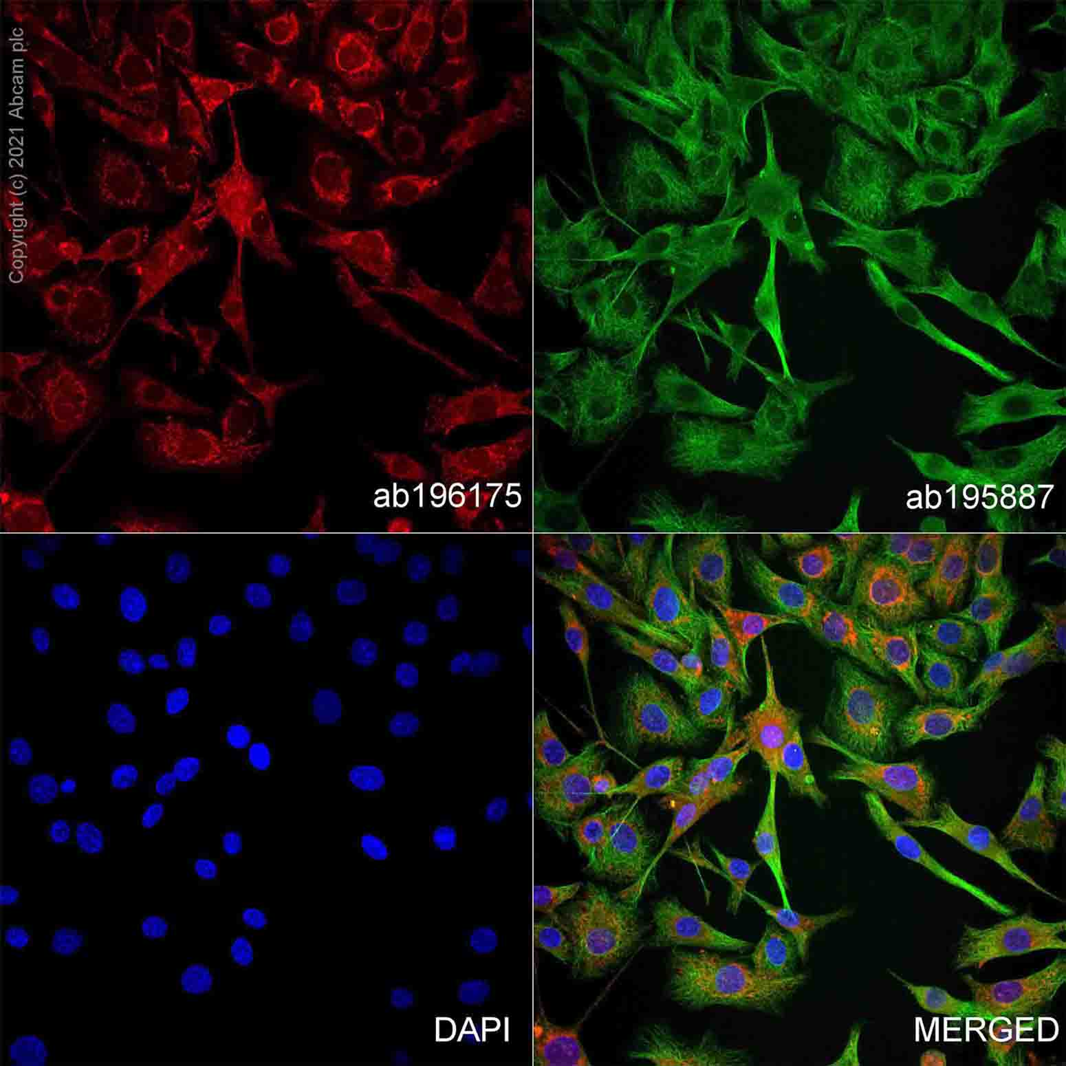 Immunocytochemistry/ Immunofluorescence - Alexa Fluor® 647 Anti-S100 beta antibody [EP1576Y] - Astrocyte Marker (AB196175), expandable thumbnail