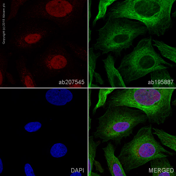 Immunocytochemistry/ Immunofluorescence - Alexa Fluor® 647 Anti-S100A11 antibody [EPR11172] (AB207545)