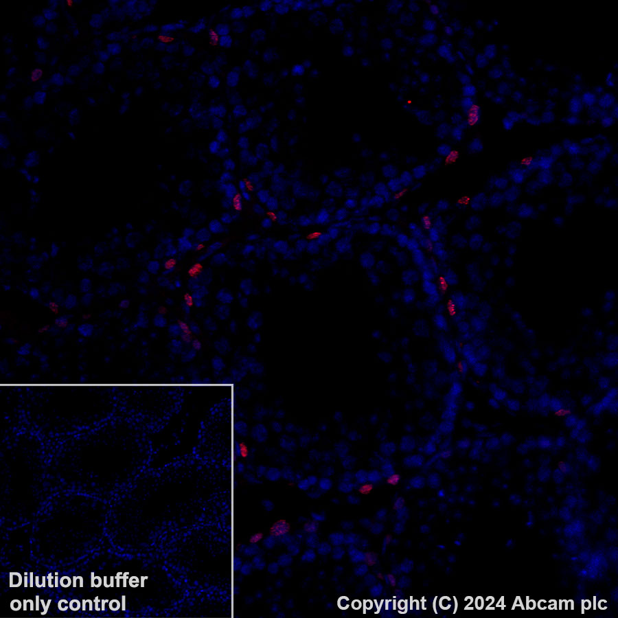 Immunohistochemistry (Formalin/PFA-fixed paraffin-embedded sections) - Alexa Fluor® 647 Anti-Sall4 antibody [EPR27143-83] (AB317293), expandable thumbnail