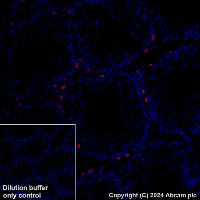 Immunohistochemistry (Formalin/PFA-fixed paraffin-embedded sections) - Alexa Fluor® 647 Anti-Sall4 antibody [EPR27143-83] (AB317293)