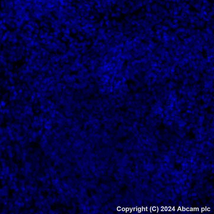 Immunohistochemistry (Formalin/PFA-fixed paraffin-embedded sections) - Alexa Fluor® 647 Anti-Sall4 antibody [EPR27143-83] (AB317293), expandable thumbnail