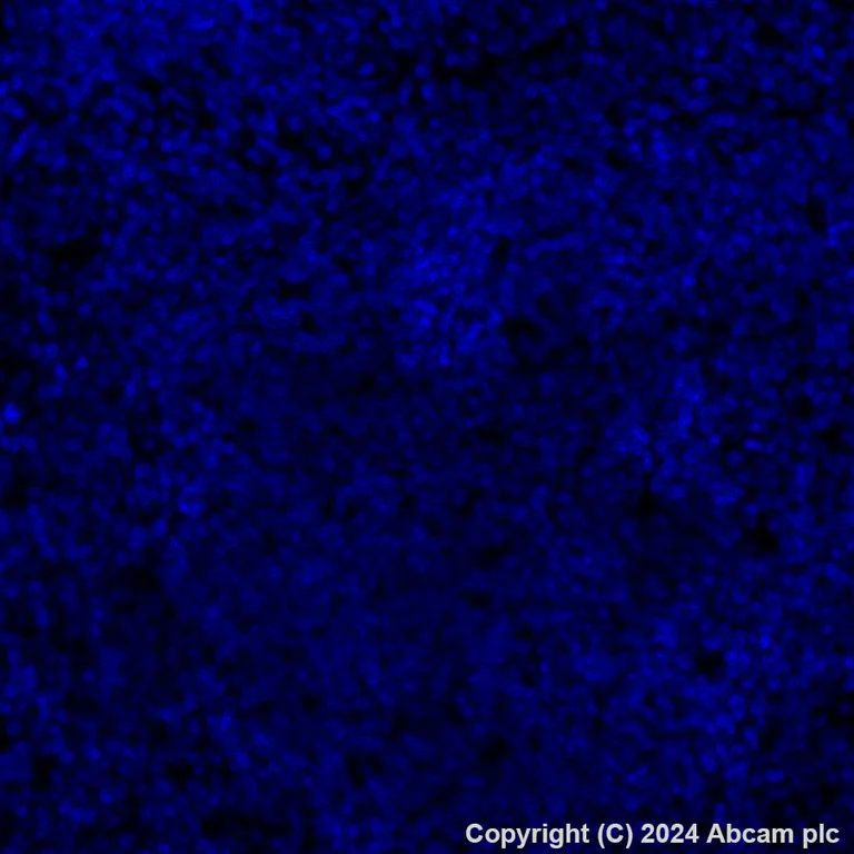 Immunohistochemistry (Formalin/PFA-fixed paraffin-embedded sections) - Alexa Fluor® 647 Anti-Sall4 antibody [EPR27143-83] (AB317293)