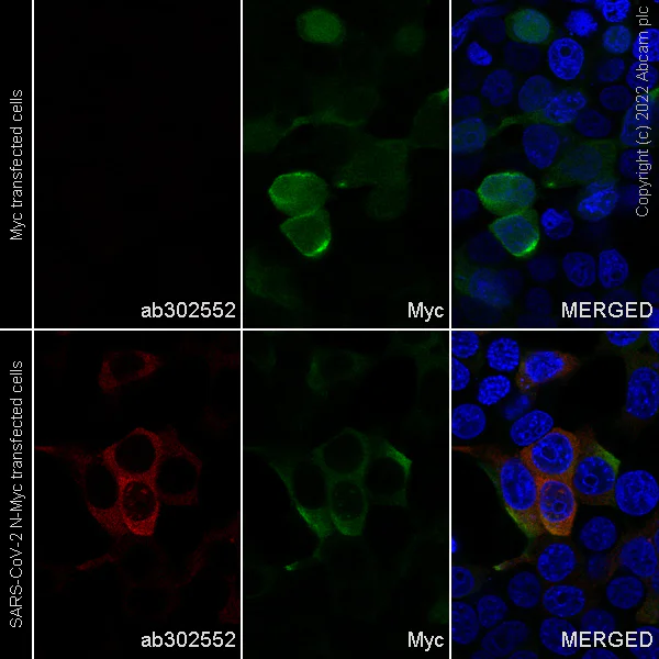 Immunocytochemistry - Alexa Fluor® 647 Anti-SARS-CoV-2 nucleocapsid protein antibody [EPR24334-118] (AB302552)