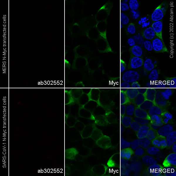 Immunocytochemistry - Alexa Fluor® 647 Anti-SARS-CoV-2 nucleocapsid protein antibody [EPR24334-118] (AB302552)
