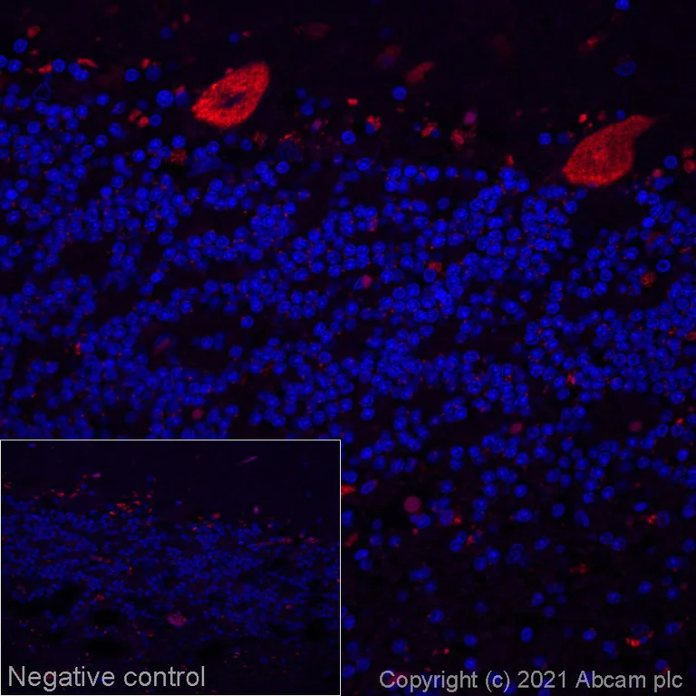 Immunohistochemistry (Formalin/PFA-fixed paraffin-embedded sections) - Alexa Fluor® 647 Anti-SCA2 antibody [EPR23630-49] (AB286816)