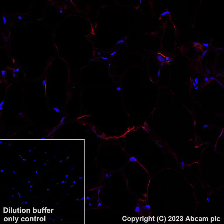 Immunohistochemistry (Formalin/PFA-fixed paraffin-embedded sections) - Alexa Fluor® 647 Anti-SCD1 antibody [EPR21963] (AB314925)