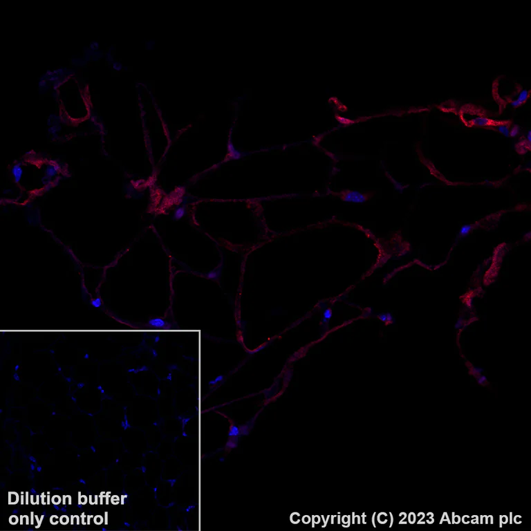 Immunohistochemistry (Formalin/PFA-fixed paraffin-embedded sections) - Alexa Fluor® 647 Anti-SCD1 antibody [EPR21963] (AB314925)