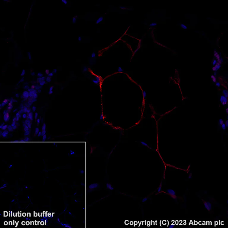 Immunohistochemistry (Formalin/PFA-fixed paraffin-embedded sections) - Alexa Fluor® 647 Anti-SCD1 antibody [EPR21963] (AB314925)