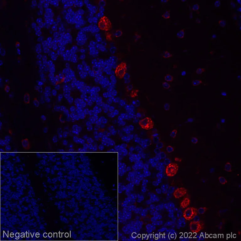 Immunohistochemistry (Formalin/PFA-fixed paraffin-embedded sections) - Alexa Fluor® 647 Anti-Scn1a antibody [EPR22326-112] (AB288363)