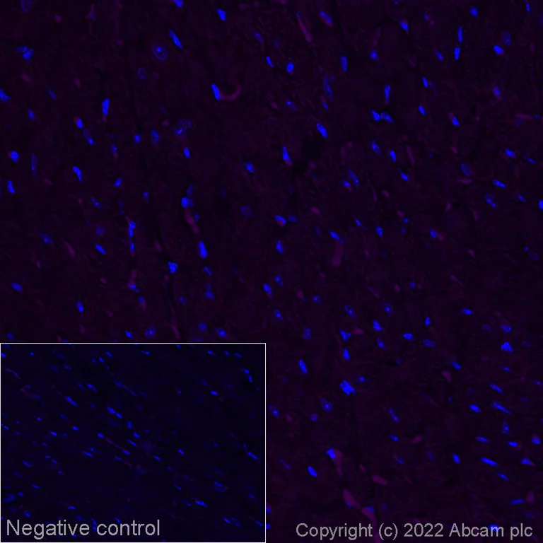 Immunohistochemistry (Formalin/PFA-fixed paraffin-embedded sections) - Alexa Fluor® 647 Anti-Scn1a antibody [EPR22326-112] (AB288363)