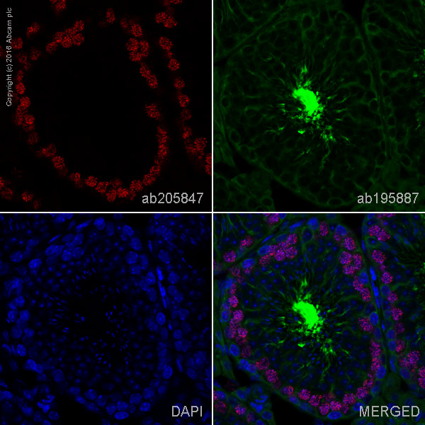 Immunohistochemistry (Formalin/PFA-fixed paraffin-embedded sections) - Alexa Fluor® 647 Anti-SCP3 antibody [Cor 10G11/7] (AB205847), expandable thumbnail