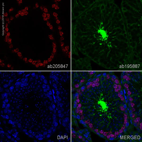 Immunohistochemistry (Formalin/PFA-fixed paraffin-embedded sections) - Alexa Fluor® 647 Anti-SCP3 antibody [Cor 10G11/7] (AB205847)
