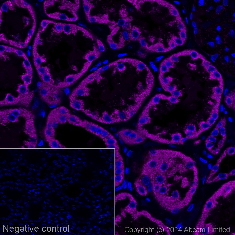 Immunohistochemistry (Formalin/PFA-fixed paraffin-embedded sections) - Alexa Fluor® 647 Anti-SDHA antibody [EPR9043(B)] (AB310057), expandable thumbnail