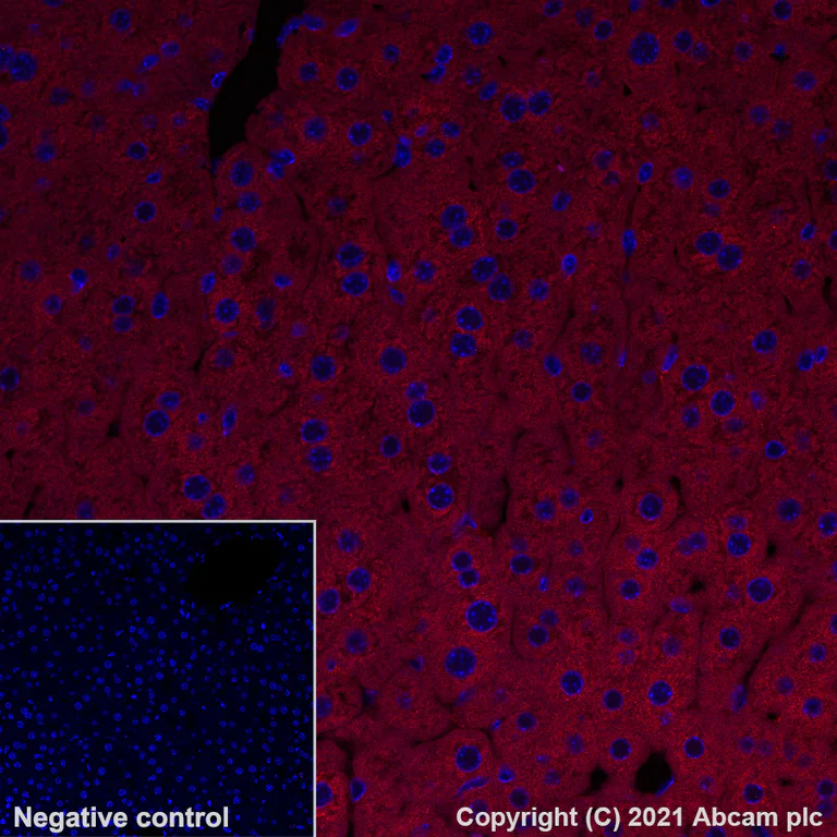 Immunohistochemistry (Formalin/PFA-fixed paraffin-embedded sections) - Alexa Fluor® 647 Anti-SEC23B antibody [EPR22723-24] (AB283504)
