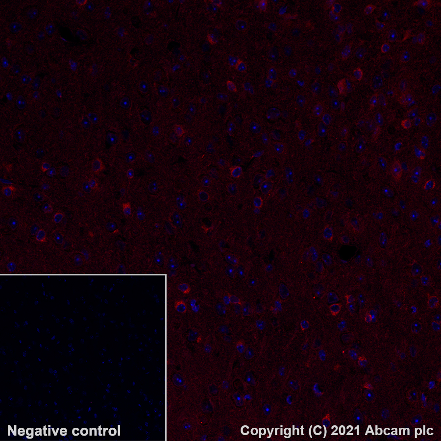 Immunohistochemistry (Formalin/PFA-fixed paraffin-embedded sections) - Alexa Fluor® 647 Anti-SEC23B antibody [EPR22723-24] (AB283504), expandable thumbnail
