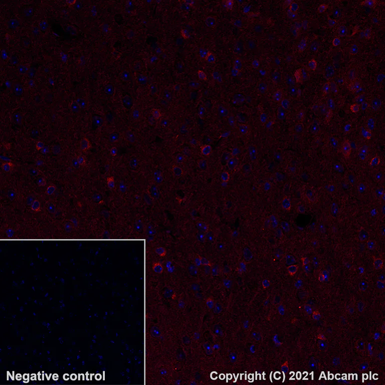 Immunohistochemistry (Formalin/PFA-fixed paraffin-embedded sections) - Alexa Fluor® 647 Anti-SEC23B antibody [EPR22723-24] (AB283504)