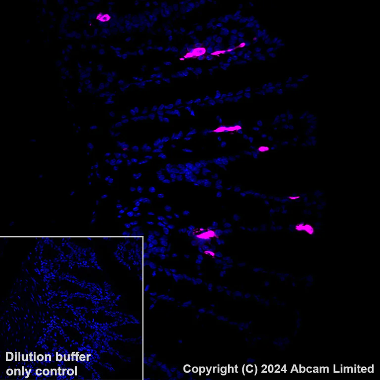 Immunohistochemistry (Formalin/PFA-fixed paraffin-embedded sections) - Alexa Fluor® 647 Anti-Serotonin antibody [EPR24431-201] (AB320779)