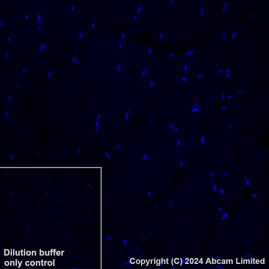 Immunohistochemistry (Formalin/PFA-fixed paraffin-embedded sections) - Alexa Fluor® 647 Anti-Serotonin antibody [EPR24431-201] (AB320779), expandable thumbnail
