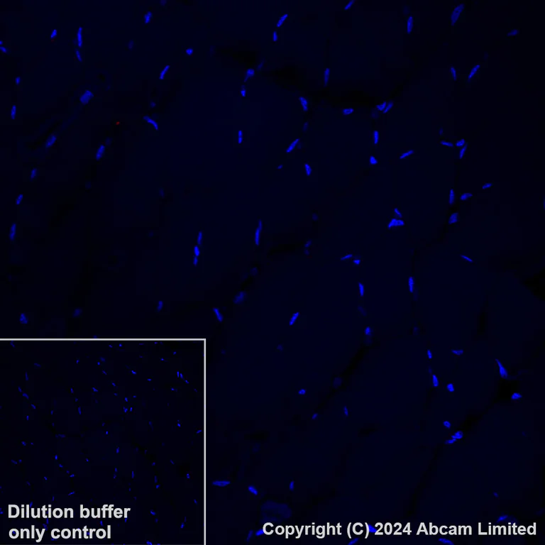 Immunohistochemistry (Formalin/PFA-fixed paraffin-embedded sections) - Alexa Fluor® 647 Anti-Serotonin antibody [EPR24431-201] (AB320779)
