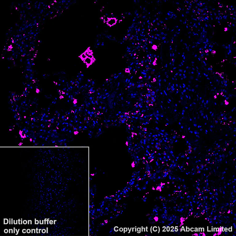 Immunohistochemistry (Formalin/PFA-fixed paraffin-embedded sections) - Alexa Fluor® 647 Anti-SFTPA1 + SFTPA2 antibody [EPR29098-6] (AB324340)