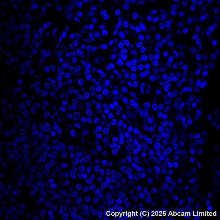 Immunohistochemistry (Formalin/PFA-fixed paraffin-embedded sections) - Alexa Fluor® 647 Anti-SFTPA1 + SFTPA2 antibody [EPR29098-6] (AB324340)