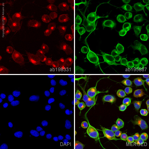 Immunocytochemistry/ Immunofluorescence - Alexa Fluor® 647 Anti-SGK1 antibody [Y238] (AB198331)