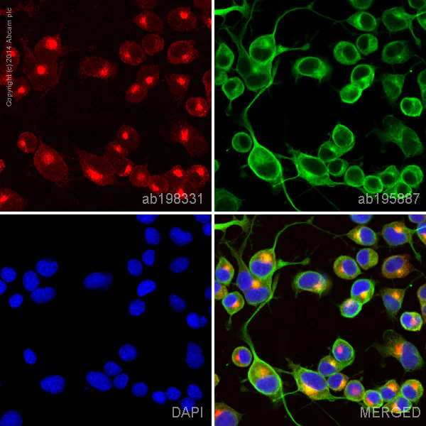 Immunocytochemistry/ Immunofluorescence - Alexa Fluor® 647 Anti-SGK1 antibody [Y238] (AB198331)
