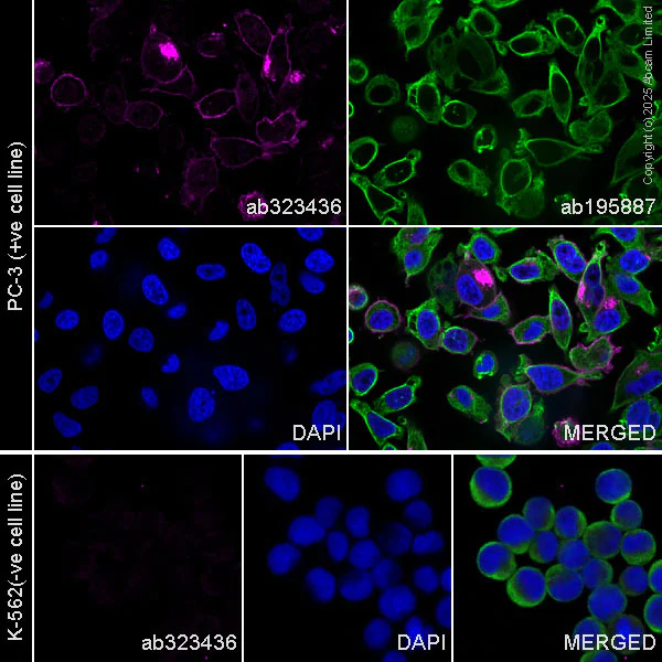 Immunocytochemistry/ Immunofluorescence - Alexa Fluor® 647 Anti-SLC16A3/MCT 4 antibody [EPR28177-30] (AB323436)