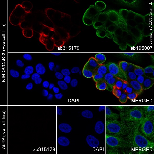 Immunocytochemistry/ Immunofluorescence - Alexa Fluor® 647 Anti-SLC34A2 - N-terminal antibody [SP322] (AB315179), expandable thumbnail