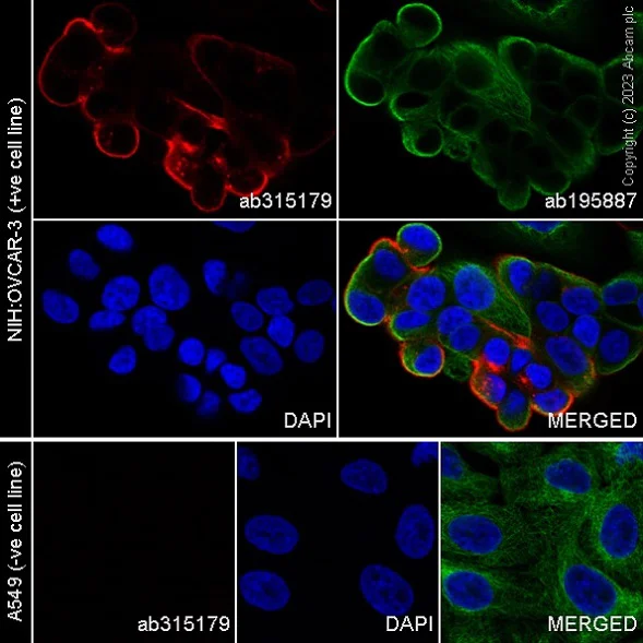 Immunocytochemistry/ Immunofluorescence - Alexa Fluor® 647 Anti-SLC34A2 - N-terminal antibody [SP322] (AB315179)
