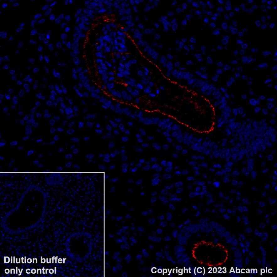 Immunohistochemistry (Formalin/PFA-fixed paraffin-embedded sections) - Alexa Fluor® 647 Anti-SLC34A2 - N-terminal antibody [SP322] (AB315179), expandable thumbnail