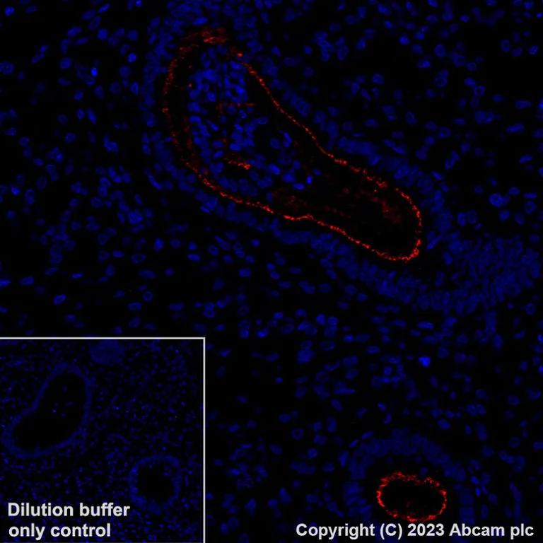 Immunohistochemistry (Formalin/PFA-fixed paraffin-embedded sections) - Alexa Fluor® 647 Anti-SLC34A2 - N-terminal antibody [SP322] (AB315179)
