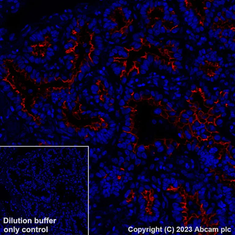 Immunohistochemistry (Formalin/PFA-fixed paraffin-embedded sections) - Alexa Fluor® 647 Anti-SLC34A2 - N-terminal antibody [SP322] (AB315179)
