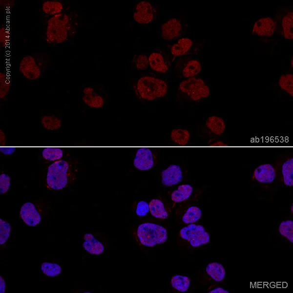 Immunocytochemistry/ Immunofluorescence - Alexa Fluor® 647 Anti-Smad2 antibody [EP567Y] (AB196538)
