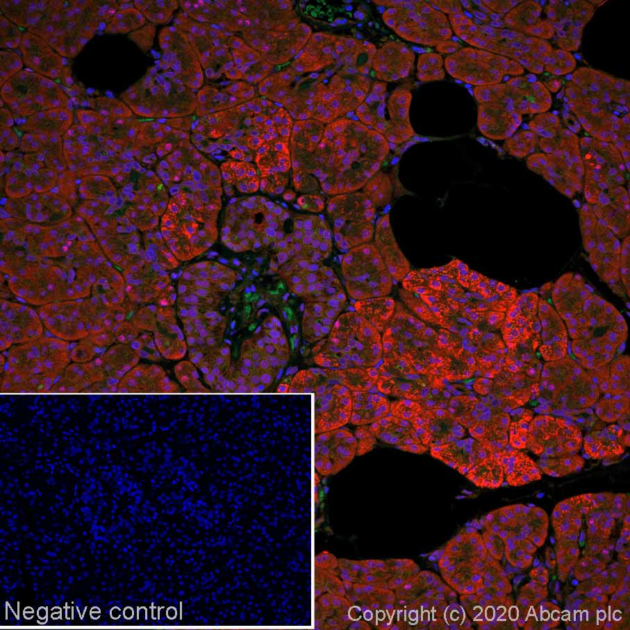 Immunohistochemistry (Formalin/PFA-fixed paraffin-embedded sections) - Alexa Fluor® 647 Anti-Smad4 antibody [SP306] - C-terminal (AB267521)