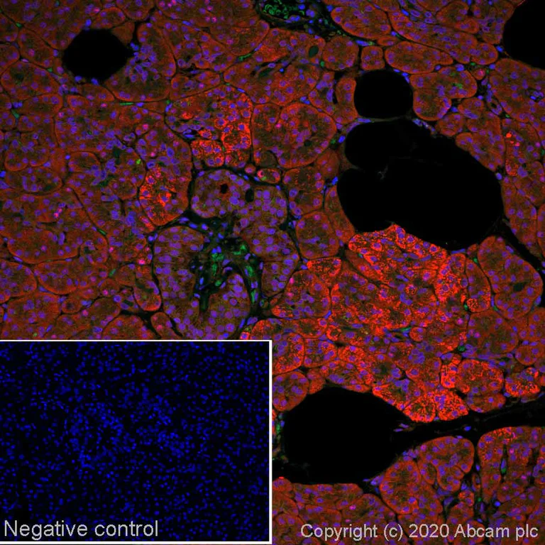Immunohistochemistry (Formalin/PFA-fixed paraffin-embedded sections) - Alexa Fluor® 647 Anti-Smad4 antibody [SP306] - C-terminal (AB267521)