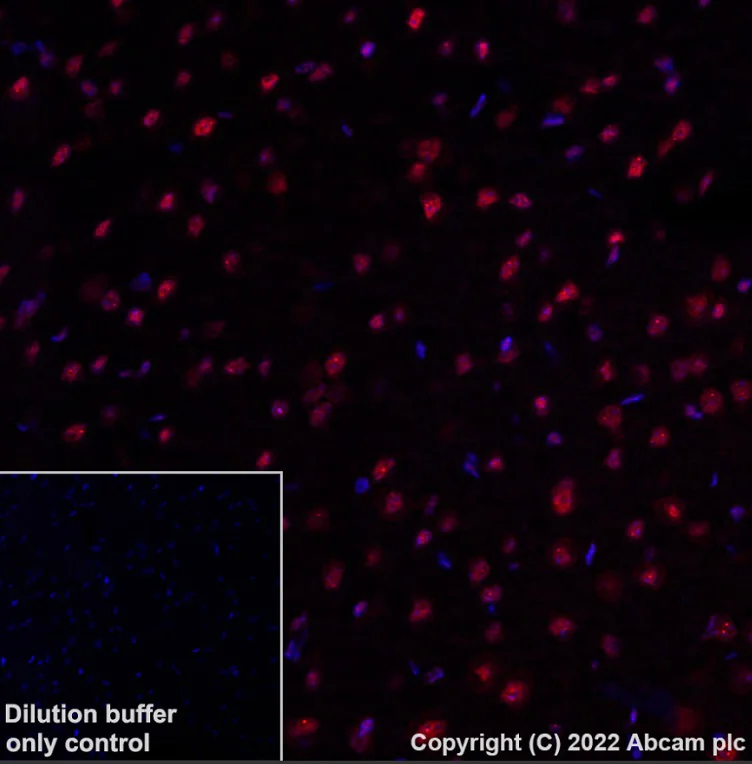 Immunohistochemistry (Formalin/PFA-fixed paraffin-embedded sections) - Alexa Fluor® 647 Anti-SMARCA2 / BRM antibody [EPR23103-44] (AB307771)