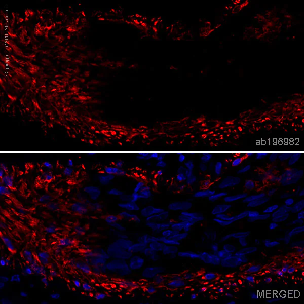 セントポーリア AB (AV) Mint Ice Ice Mountain® Spring Water | 12 Liter oz 24-Pack | ReadyRefresh