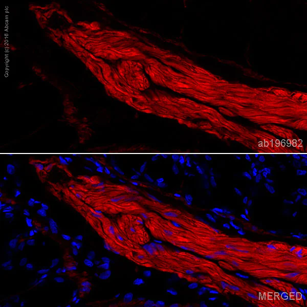 Anti-smooth muscle Myosin heavy chain 11 Alexa Fluor® 647