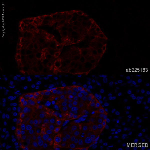 Immunohistochemistry (Formalin/PFA-fixed paraffin-embedded sections) - Alexa Fluor® 647 Anti-Somatostatin Receptor 2 antibody [UMB1] (AB225183), expandable thumbnail