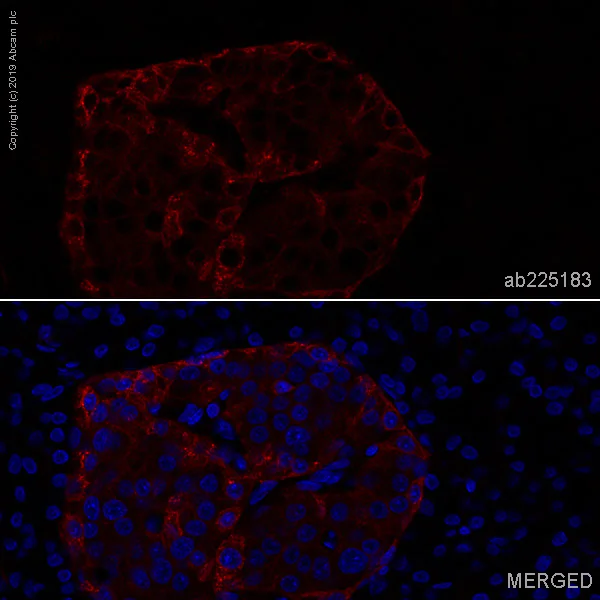 Immunohistochemistry (Formalin/PFA-fixed paraffin-embedded sections) - Alexa Fluor® 647 Anti-Somatostatin Receptor 2 antibody [UMB1] (AB225183)