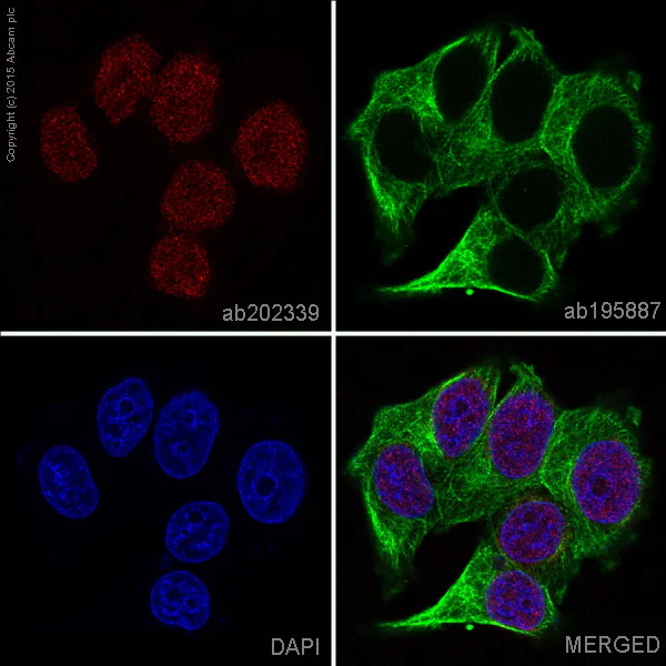 Immunocytochemistry/ Immunofluorescence - Alexa Fluor® 647 Anti-SOX1 antibody [EPR4766] (AB202339)