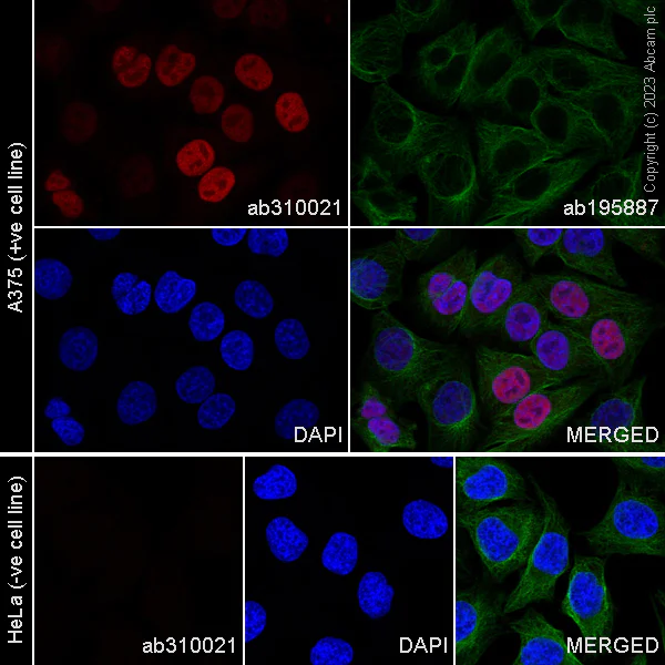 Immunocytochemistry/ Immunofluorescence - Alexa Fluor® 647 Anti-SOX10 antibody [EPR4007] (AB310021)